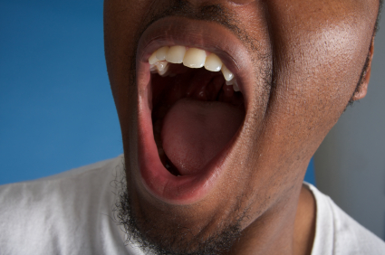 What Causes Dry Mouth: A Complete Guide